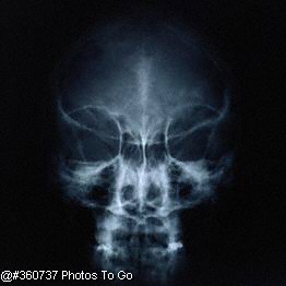 X-ray image